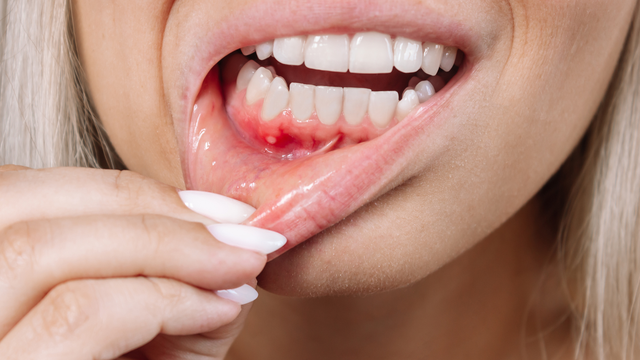 Image of happy patient in Tustin, CA